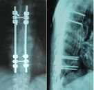 Good price X Ray Dry Medical Imaging Film Biru 8 x 10 Inch Untuk Agfa / Fuji on line