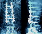Good price Blue AGFA Medical X Ray Film 10 dalam x 12 dalam, Ketajaman Tinggi on line