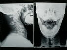 Good price Film Pencitraan Medis Kepadatan Tinggi X-Ray Kering Untuk Fuji 3000/2000/1000 on line