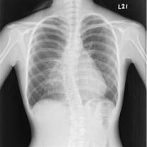 Good price Ketajaman Tinggi X-ray Dry Medical medical Film, Dry imaging movie. on line