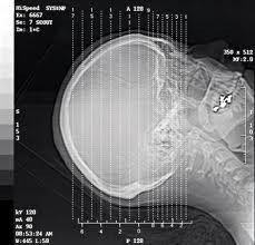Pencitraan Diagnostik Silver Halide Laser X Ray, Film Transparansi Tahan Air A3 / A4