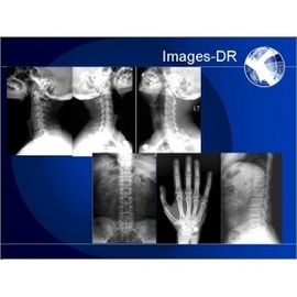 Mesin Radiografi Digital Mammogrpahy X-RAY Dengan Lengan UC Fleksibel