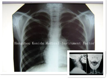 Film Medis Digital Sinar X Kering 14 x 17 inci Film Kesehatan Pencitraan Radiografi