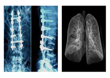 Sharp X Radiografi Medis Film, Mri Dr Ct Digital Dry Imaging Film