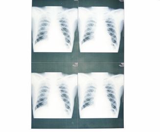 Good price White Base Medical X Ray Paper Film Moistureproof Untuk Sony / EPSON Laser Printer on line
