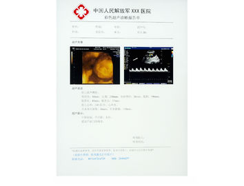 Film Medis X-ray Kertas Anti Gores Untuk KND-DRYTEC-3000, KND-DRYTEC-4000