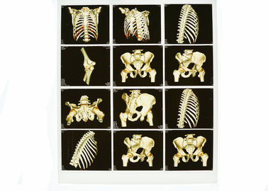 Good price Pencitraan Diagnostik White Base X Ray, Film Laser Sinar X Biru Medis on line