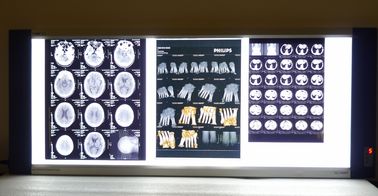 Good price 10in * 14in Digital x-ray Dry Imaging Film Untuk Printer Thermal KND-F on line