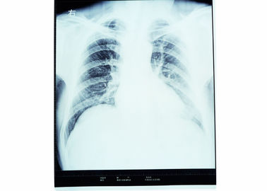 Good price Sinar-X Film Pencitraan Medis Kering Untuk AGFA 5300/5302/5500 KND-A on line