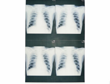 Film X-Ray Medis Basis Putih yang Dapat Dipakai, Film Kertas Pencitraan Medis Sinar-X