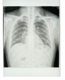 Good price Konida Laser Printer Medis X-Ray Film 11 dalam x 14 dalam KND-K CE Disetujui on line