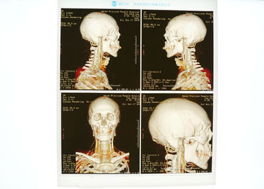 Good price Kepadatan Tinggi Medis X Ray Film Biru Untuk Printer Laser Konida on line