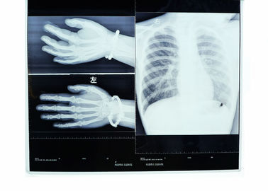 Good price Kabut Rendah 14in * 17in Pencitraan Medis Dry X-ray Transparency Thermal Printer Film on line