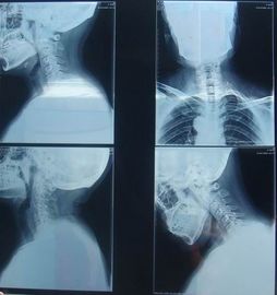 Good price KND-K Kertas Medis Anti Gores Dry Imaging Film Untuk Pemeriksaan Radiografi on line