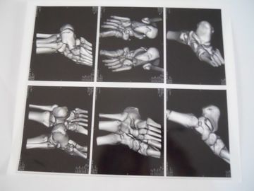 Good price Medical Dry Imaging Film Untuk Pemeriksaan X-Ray Pada AGFA 5300, 5302, 5500 on line
