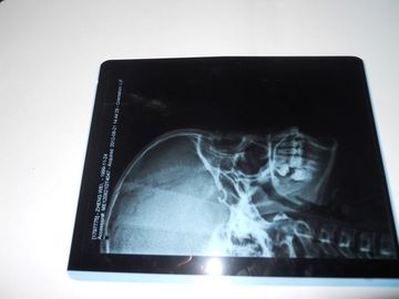 Good price KND-A Film Pencitraan Kering Medis yang Ramah Lingkungan Untuk Pemeriksaan X-Ray Pada AGFA 5300 on line