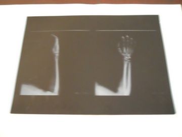KND-A Low Fog Medical Dry Imaging Film Untuk Pemeriksaan X-Ray Pada AGFA 5300 11in × 14in