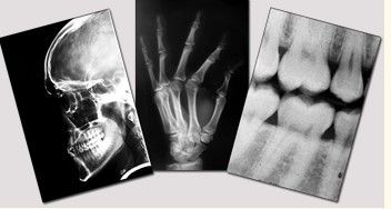 Good price Blue Medical Dry Imaging Film, Laser Fuji X Ray 11in x 14in on line