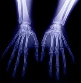 Good price Pencitraan Diagnostik Medis Digital, Film Kering X-ray CT 8 x 10 on line